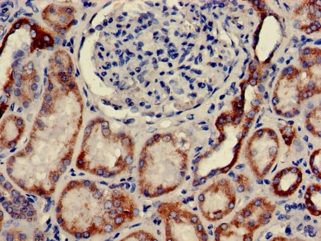 100UG CLEC18A ANTIBODY 100 ug