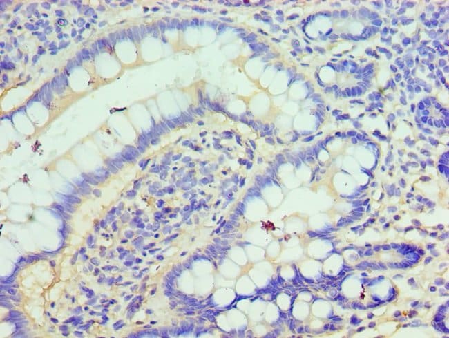 100UL CLIC1 ANTIBODY 100 ul