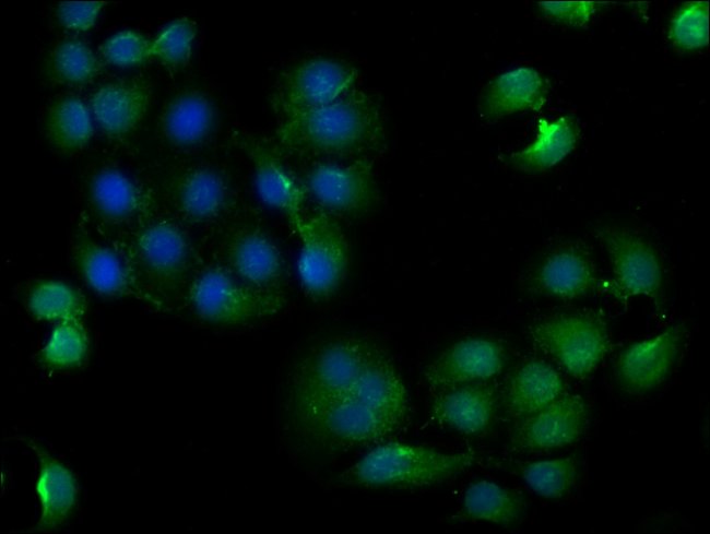 100UG CLTCL1 ANTIBODY 100 ug