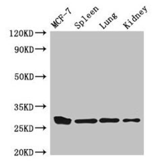 100UG MAST CELL CHYMASE ANTIBODY 100 ug