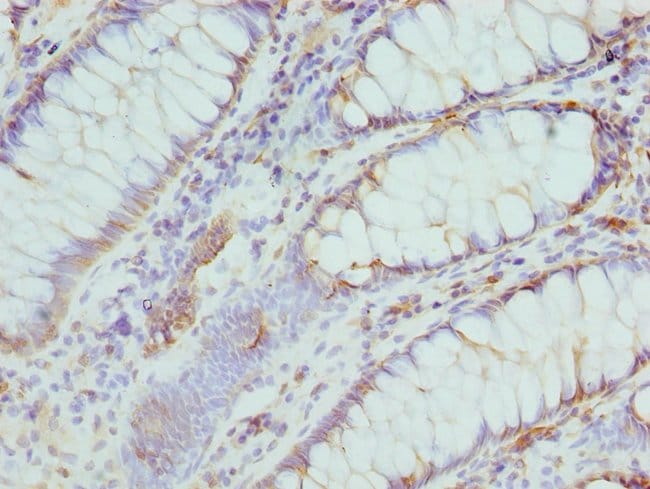100UL CMPK1 ANTIBODY 100 ul