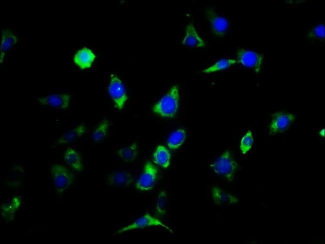 100UG CNTFR ANTIBODY 100 ug