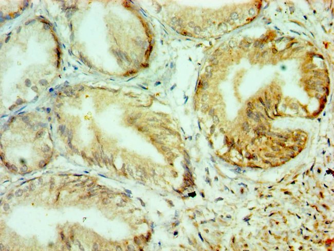 100UL COLLAGEN X ANTIBODY 100 ul