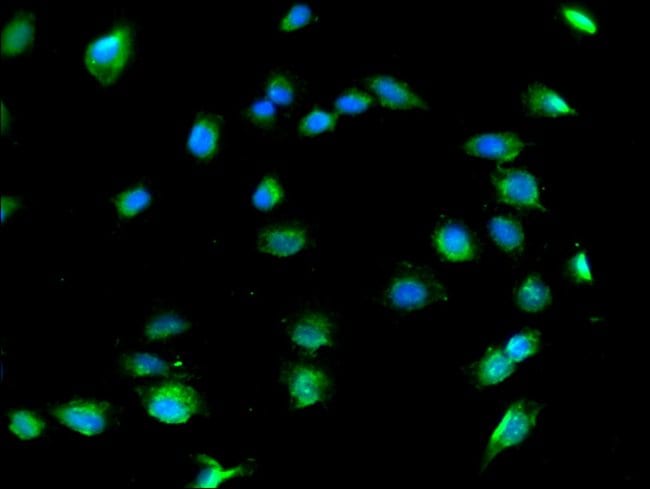 100UG COL8A1 ANTIBODY 100 ug