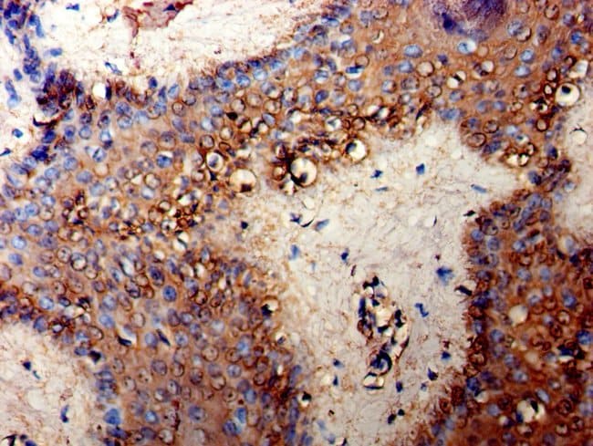 100UG TPMT ANTIBODY 100 ug