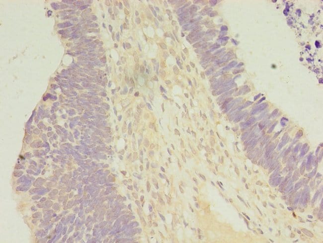 100UG CARBOXYPEPTIDASE A2 ANTIBODY 100 u