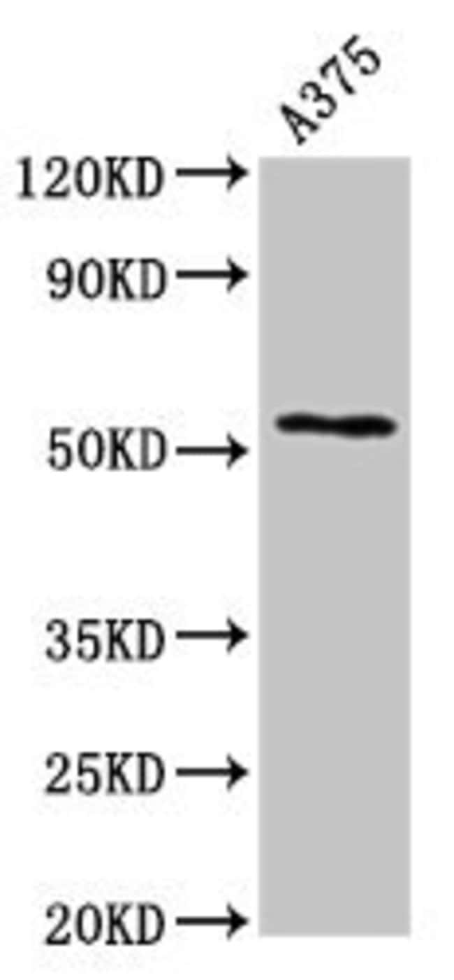 100UG CARBOXYPEPTIDASE E ANTIBODY 100 ug