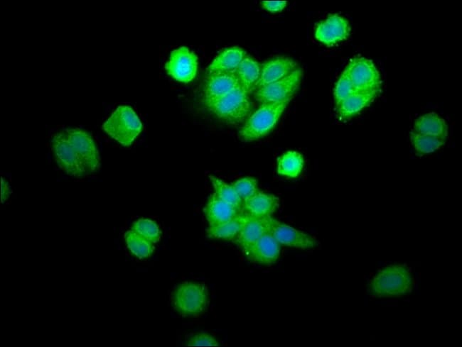 100UG CPOX ANTIBODY 100 ug