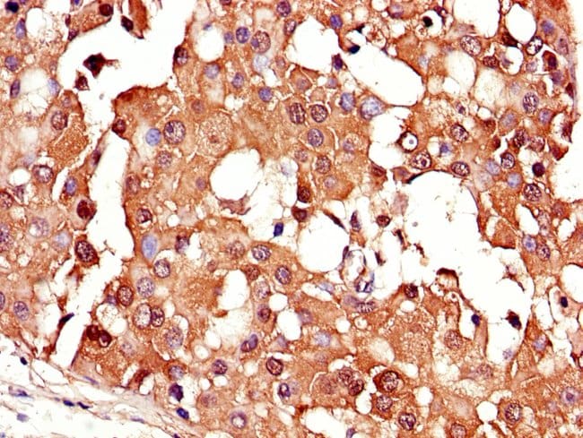100UG CRABP2 ANTIBODY 100 ug