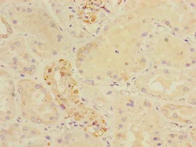 100UL CRIP1 ANTIBODY 100 ul