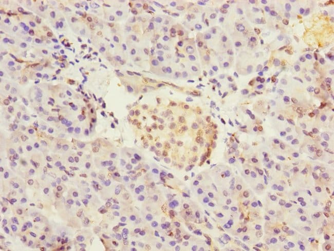 100UL CRIP2 ANTIBODY 100 ul