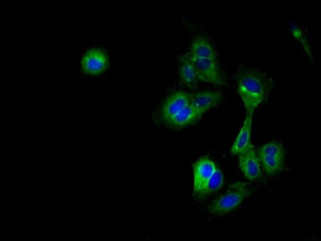 100UL CRIP2 ANTIBODY 100 ul
