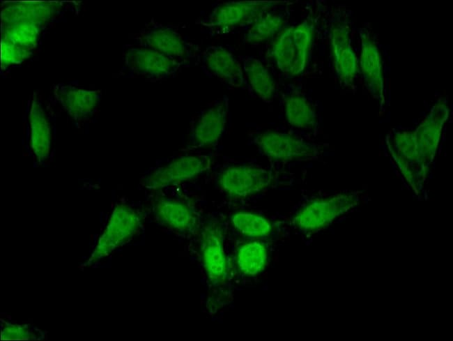 100UG CRKL ANTIBODY 100 ug