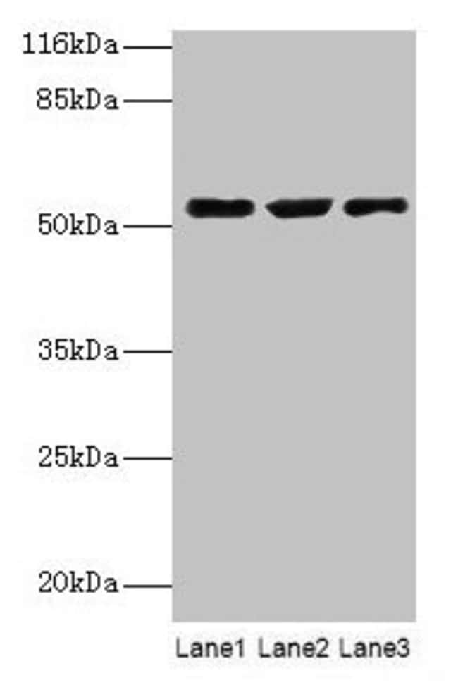 100UG CRNN ANTIBODY 100 ug