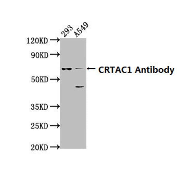 100UL CRTAC1 ANTIBODY 100 ul