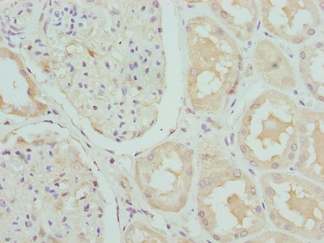 100UL CRTAP ANTIBODY 100 ul