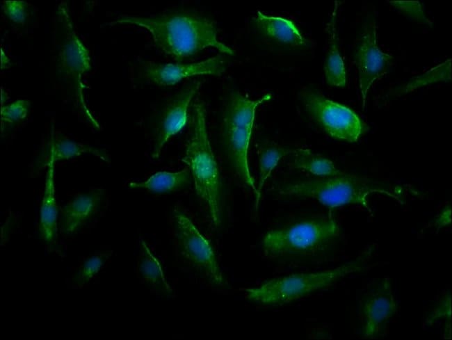 100UG CRYAB ANTIBODY 100 ug