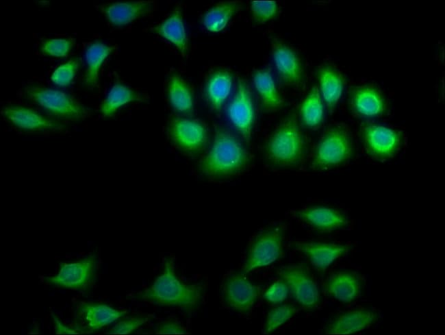 100UG CRYBA1 ANTIBODY 100 ug