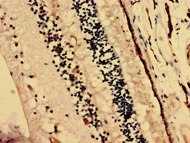 100UG CRYBA4 ANTIBODY 100 ug
