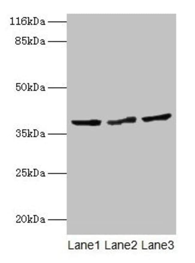 100UG CRYZL1 ANTIBODY 100 ug