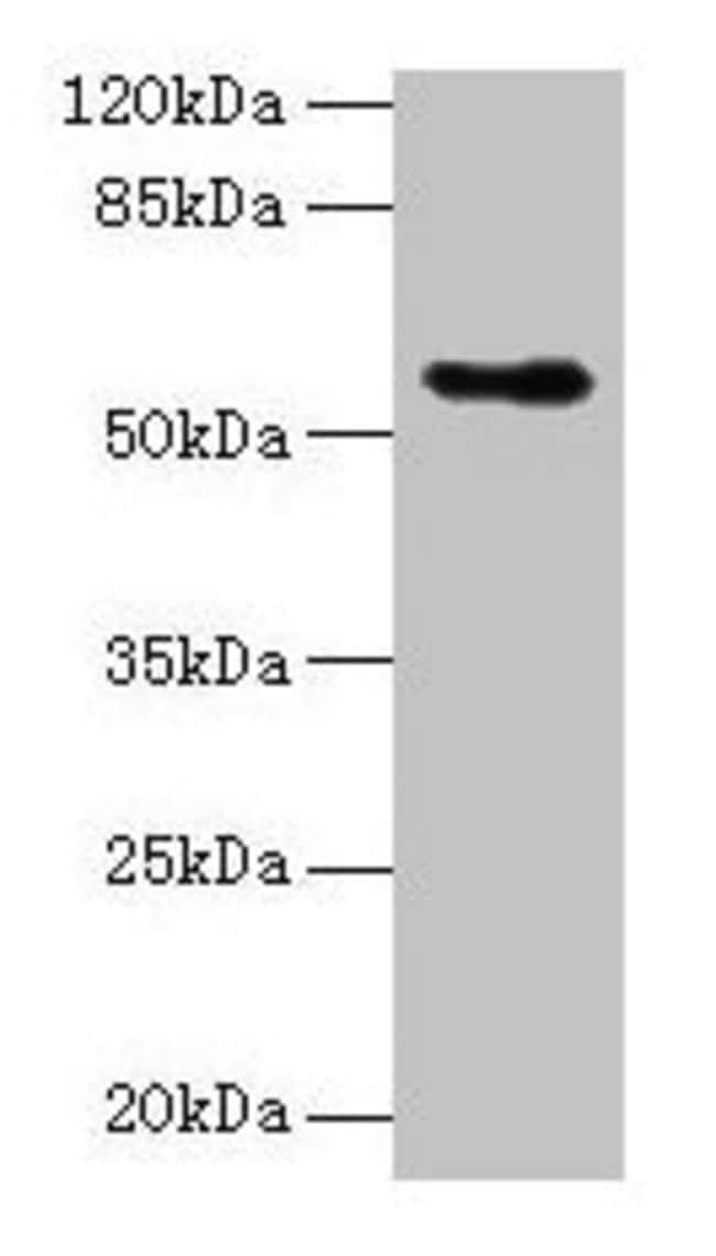 100UG CSAD ANTIBODY 100 ug