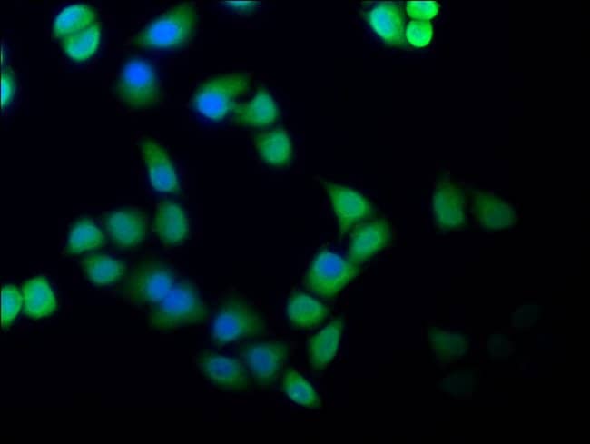 100UL CAS ANTIBODY 100 ul