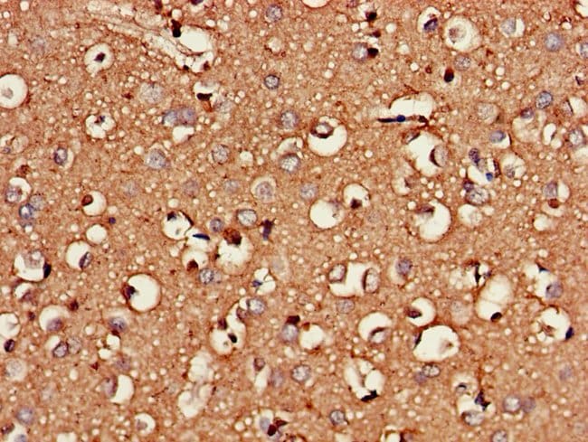 100UG CSGALNACT2 ANTIBODY 100 ug