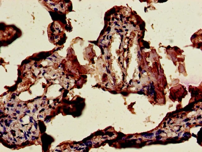 100UG CSHL1 ANTIBODY 100 ug