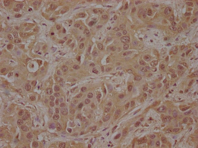 100UL CSK ANTIBODY 100 ul