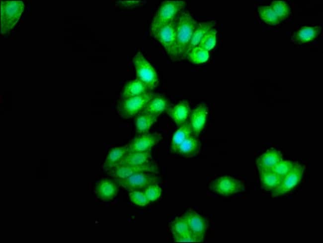 100UG CK1 DELTA ANTIBODY 100 ug
