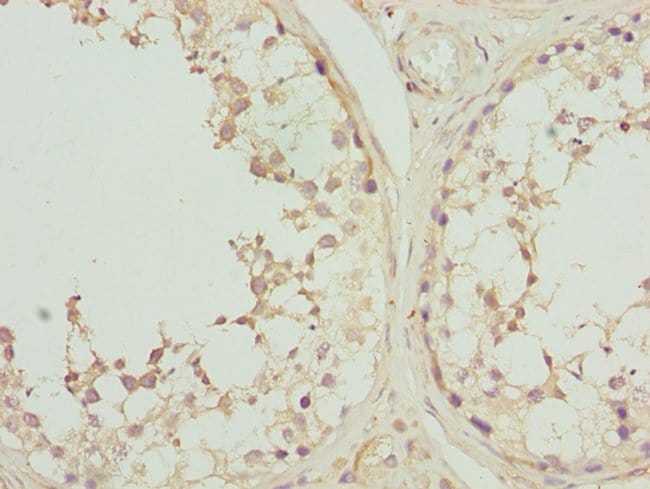 100UL CK1 GAMMA-2 ANTIBODY 100 ul