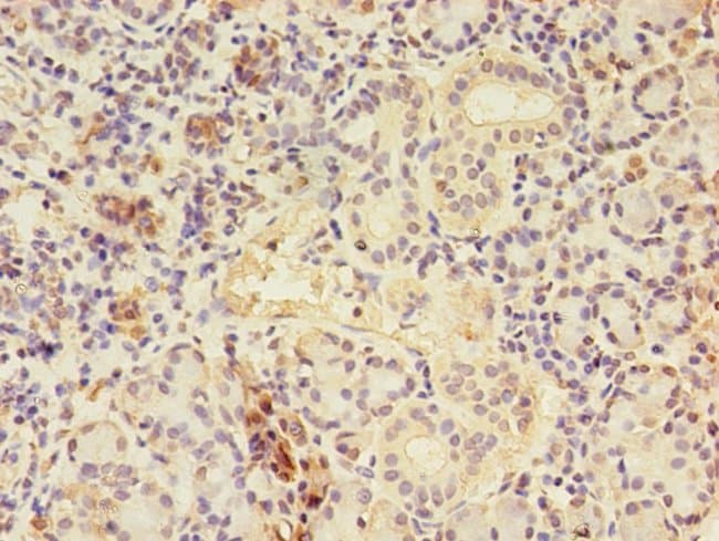 100UG CTPS ANTIBODY 100 ug