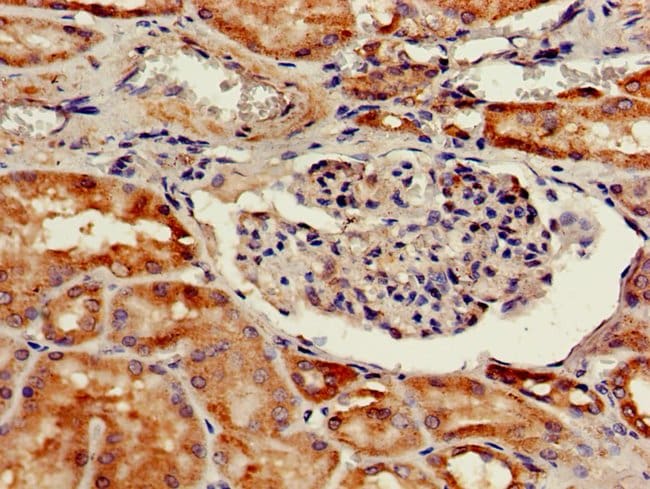 100UG CATHEPSIN H ANTIBODY 100 ug