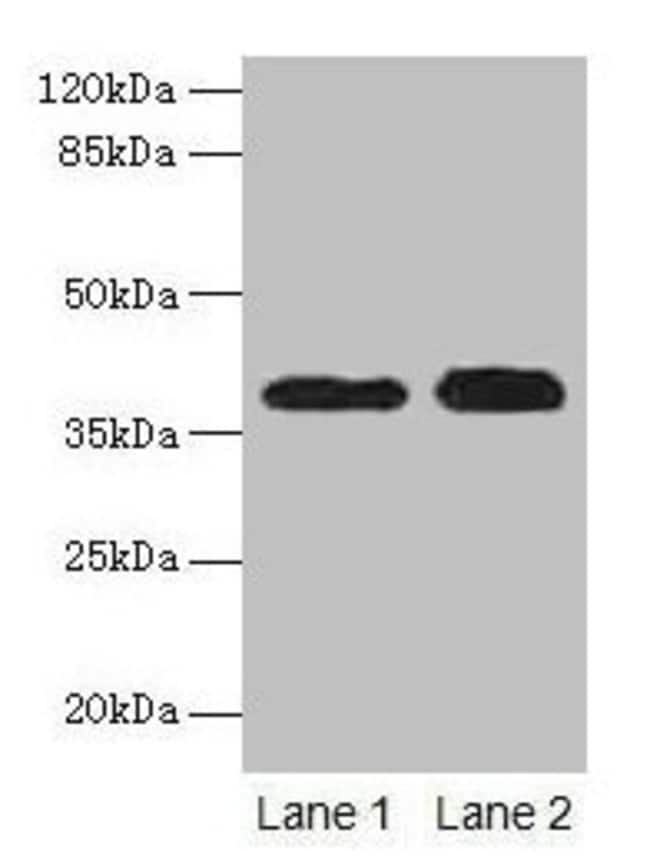 100UG CATHEPSIN L ANTIBODY 100 ug