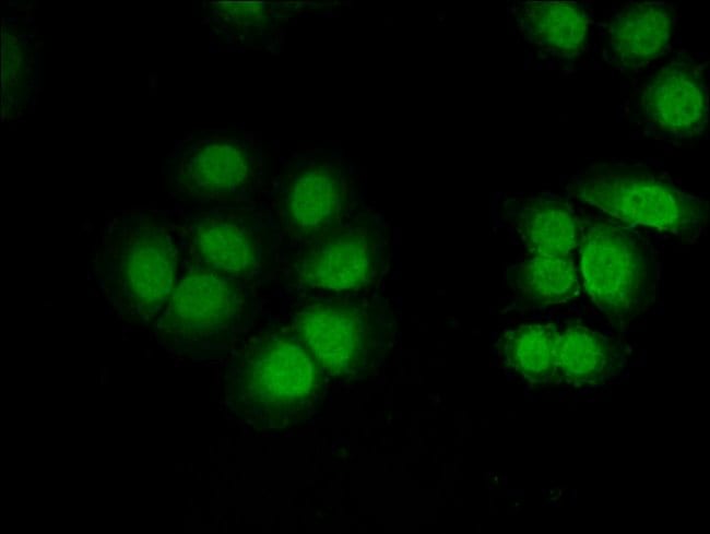 100UG CUG-BP2 ANTIBODY 100 ug