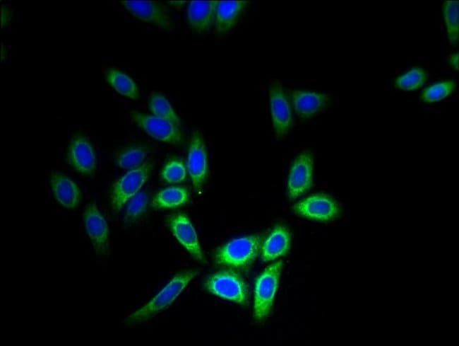 100UG CYB5B ANTIBODY 100 ug