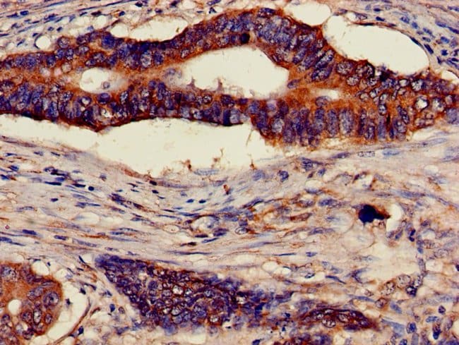 100UG ATP5D ANTIBODY 100 ug