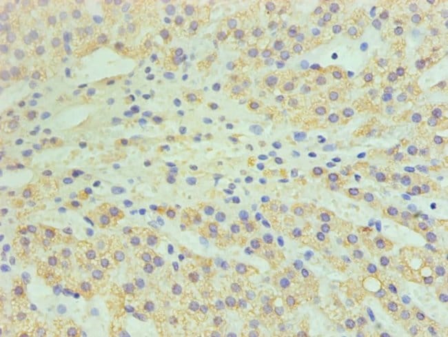 100UG CYP11A1 ANTIBODY 100 ug