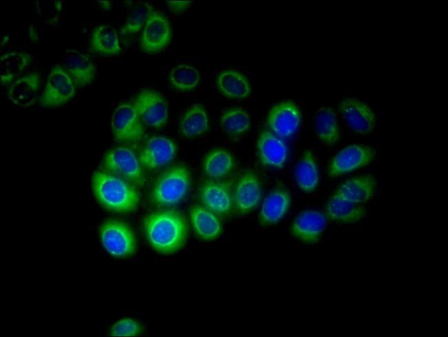100UG CYP17A1 ANTIBODY 100 ug