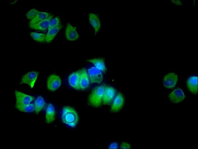 100UG CYP17A1 ANTIBODY 100 ug