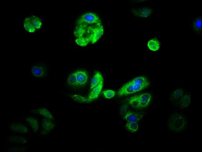100UL CYP21A2 ANTIBODY 100 ul