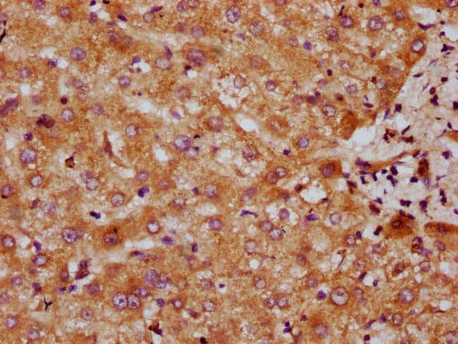 100UG CYP7A1 ANTIBODY 100 ug