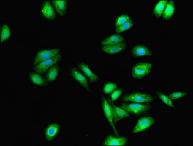 100UG CYSLTR1 ANTIBODY 100 ug