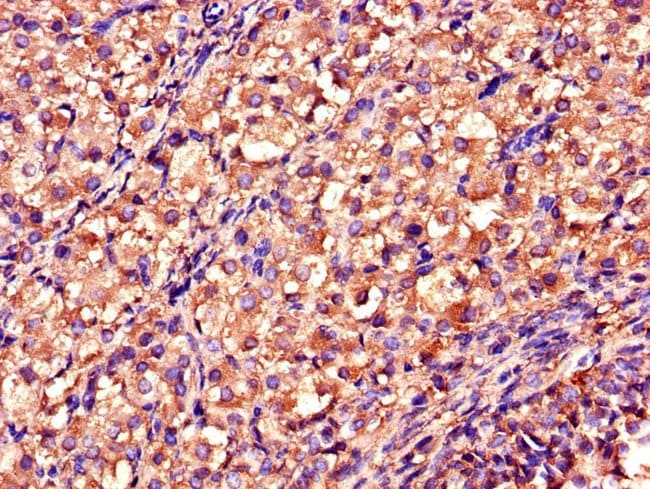 100UG DDAH2 ANTIBODY 100 ug