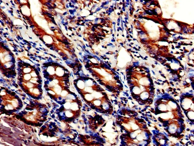 100UG DDHD2 ANTIBODY 100 ug