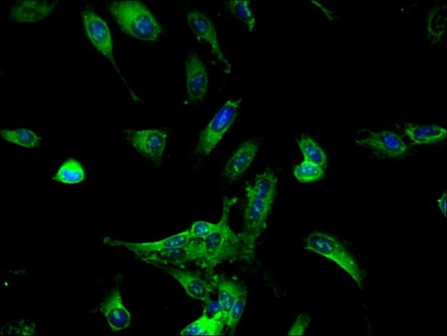 100UG DDX6 ANTIBODY 100 ug