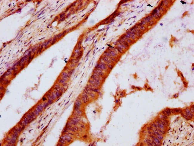 100UG DHCR7 ANTIBODY 100 ug