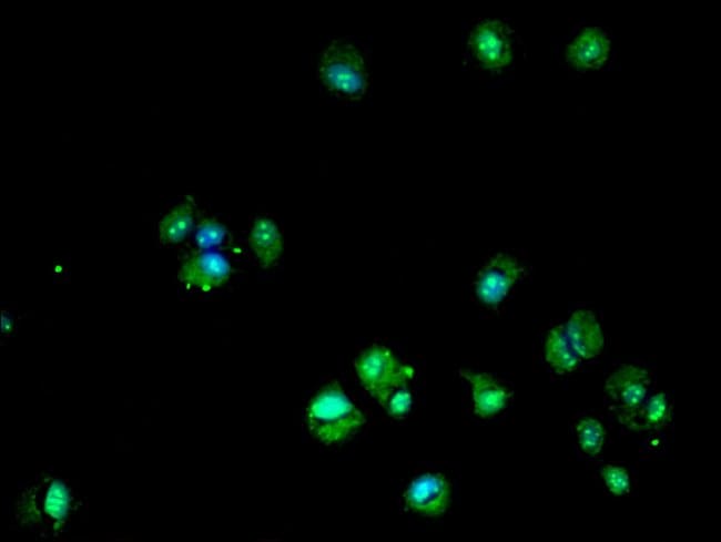 100UG DHRS12 ANTIBODY 100 ug