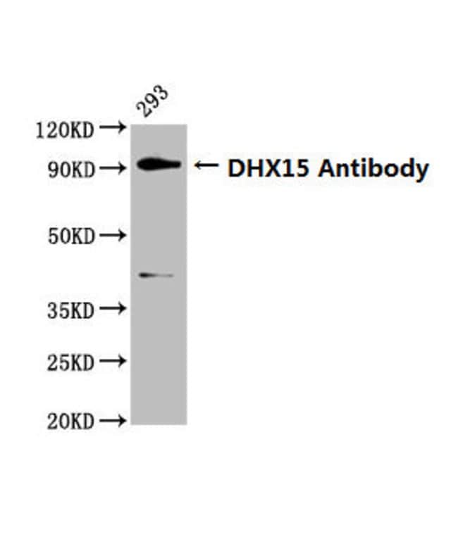 100UG DHX15 ANTIBODY 100 ug