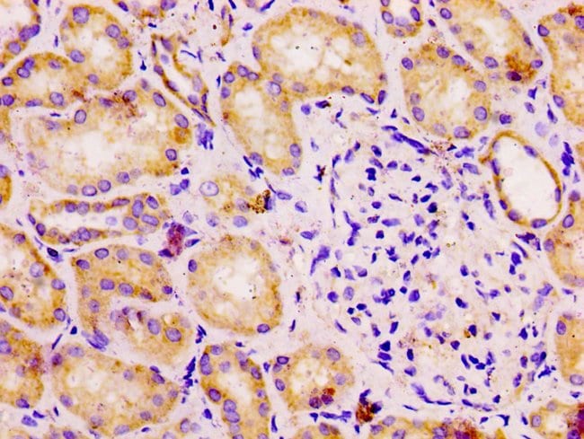 100UG DLD ANTIBODY 100 ug